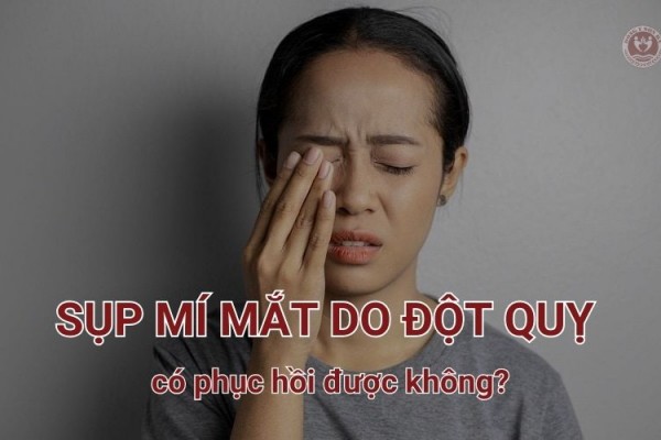 Sụp mí mắt do đột quỵ có thể hồi phục không?